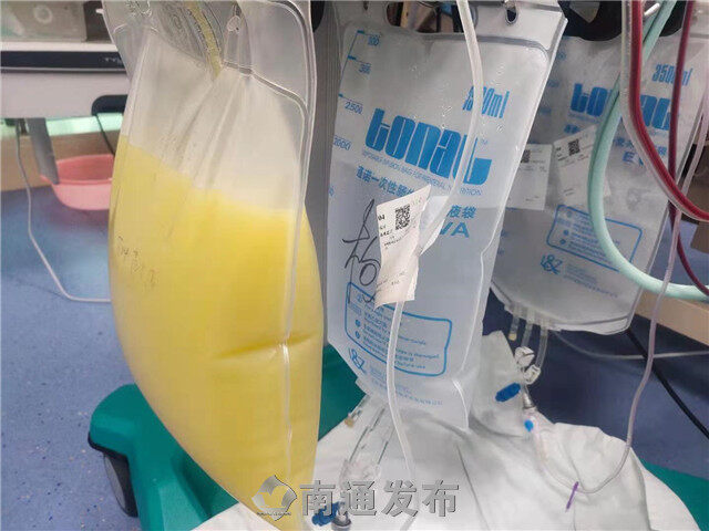 人保财险政银保 ,人保护你周全_血液净化技术：血浆置换行业2025年发展前景预测