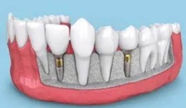 3i体验官吴克群闪耀登场AWE2025