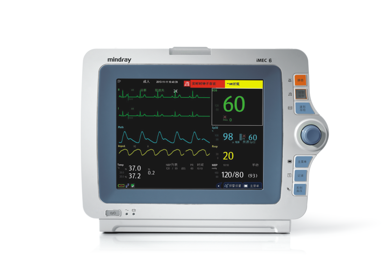 迈瑞医疗获得发明专利授权：“监护设备的控制方法、监护设备和存储介质”