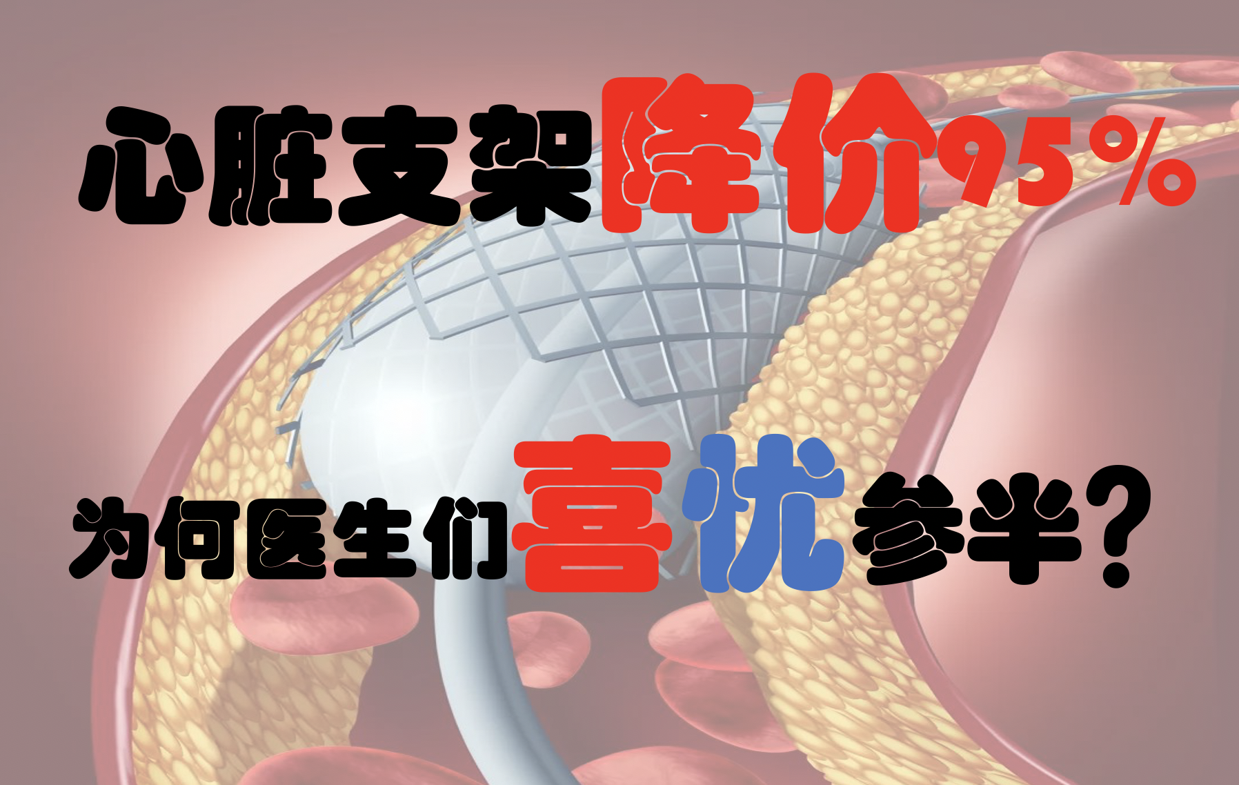 赛诺医疗：新型药物洗脱支架系统获美国FDA附条件批准