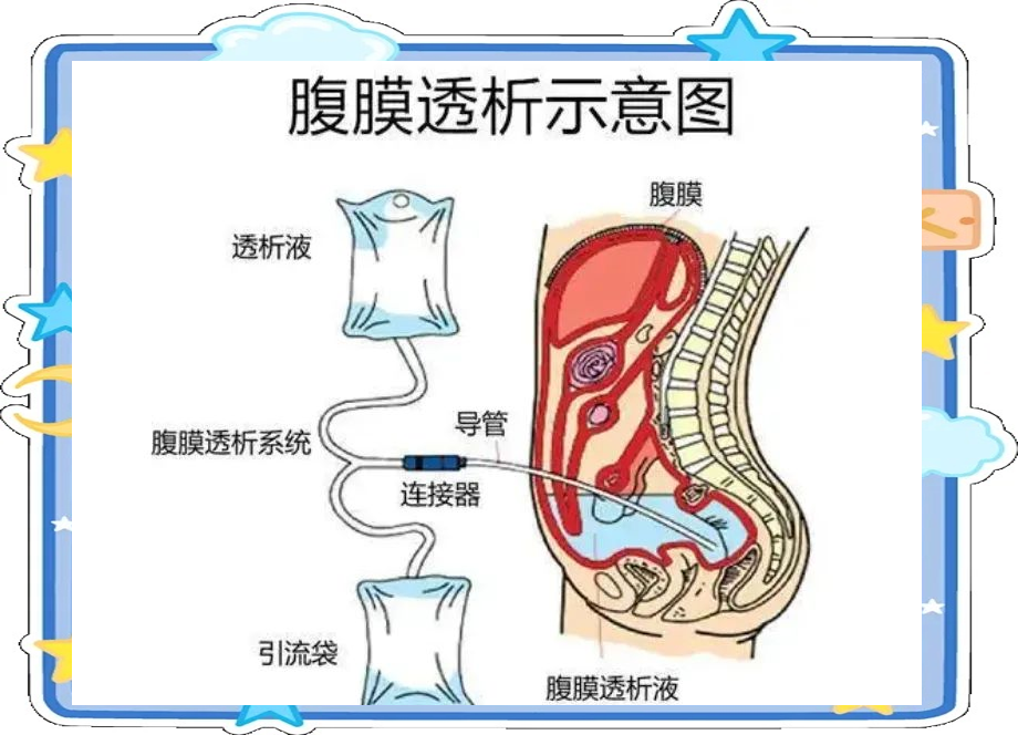 华润双鹤(600062.SH):子公司低钙腹膜透析液(碳酸氢盐)、腹膜透析液(碳酸氢盐)系列药品获得药品注册证书