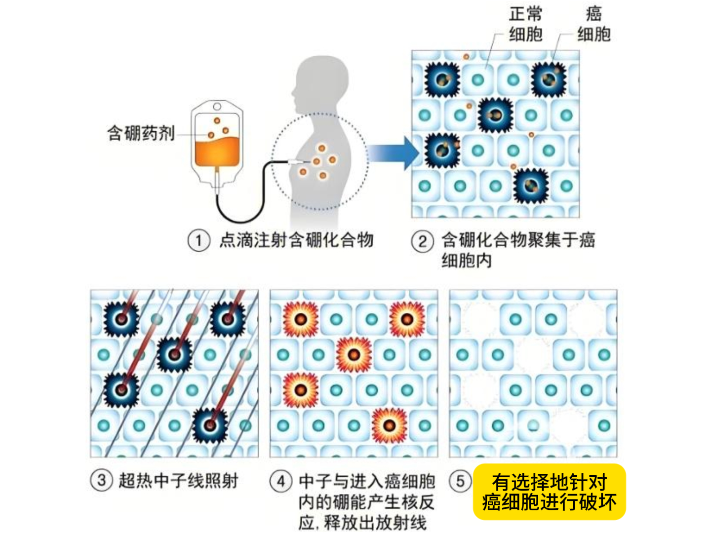 2025国谈结果公布：“药王”进医保 5款百万抗癌药进商保