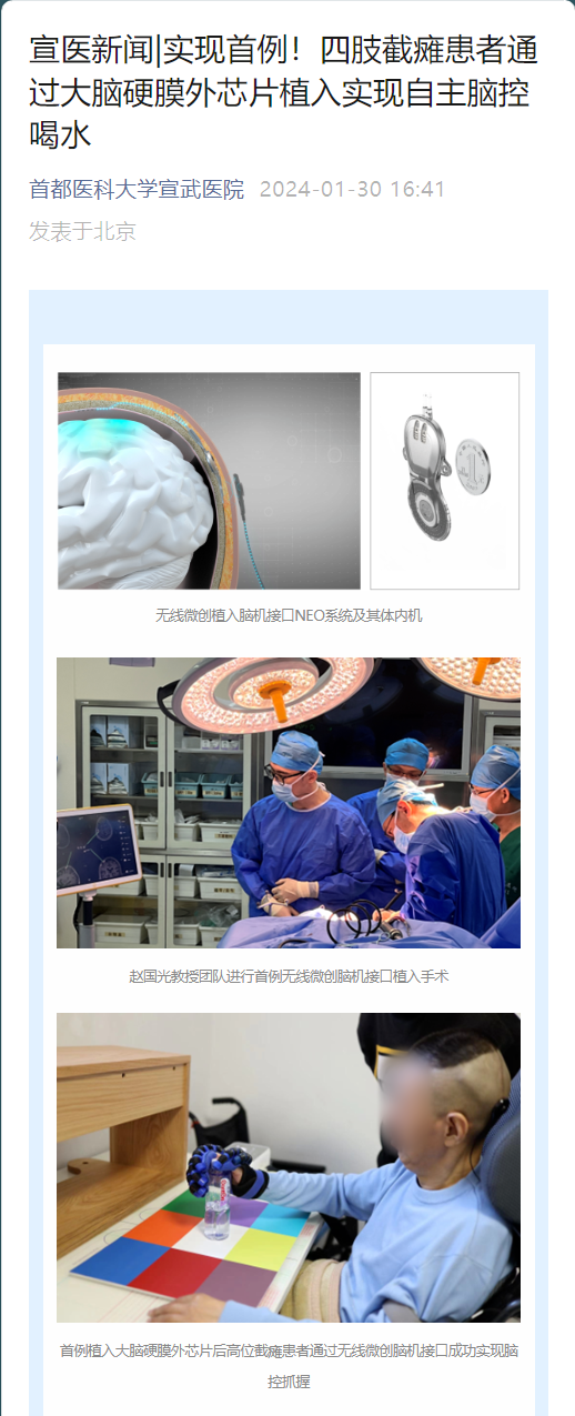 倍益康连续大涨 四川脑机接口产业大爆发