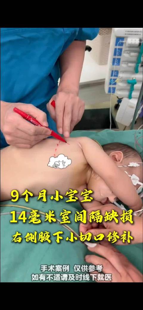 “小洛熙事件”追问：手术室应该有监控吗