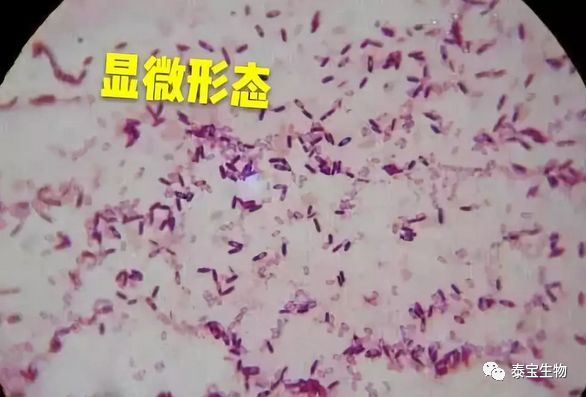 大北农获得发明专利授权：“一株枯草芽孢杆菌菌株及其发酵方法和应用”