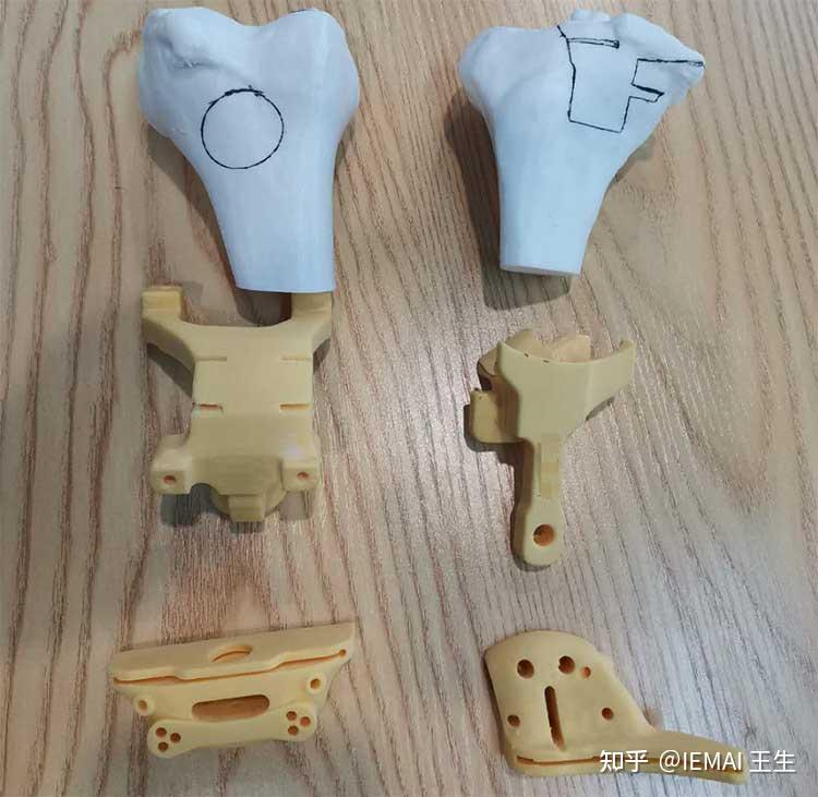 春立医疗获得发明专利授权：“一种仿生型假体截骨定位导板”